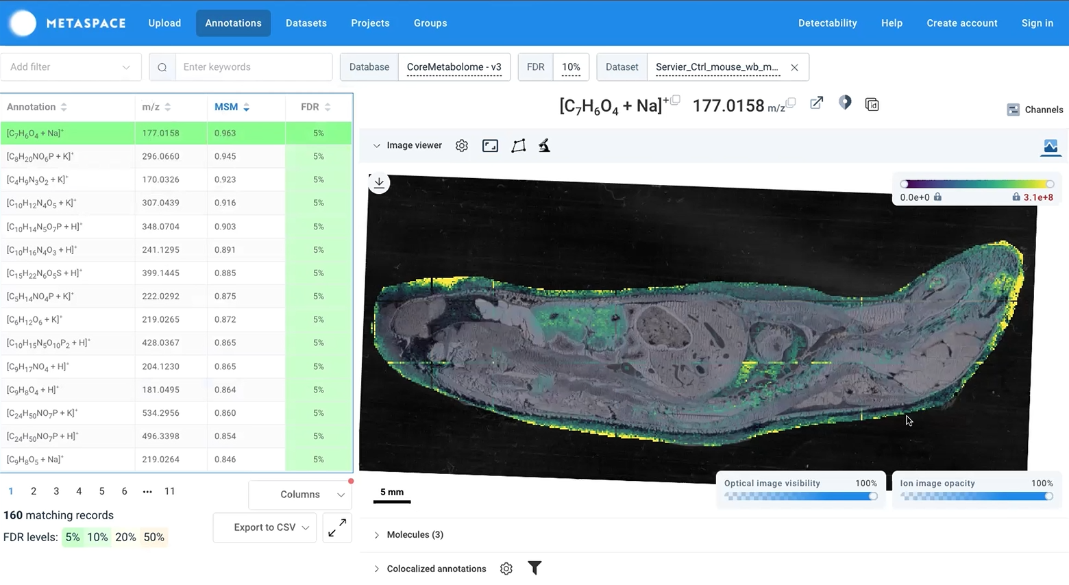 Metabolomics Interface 1